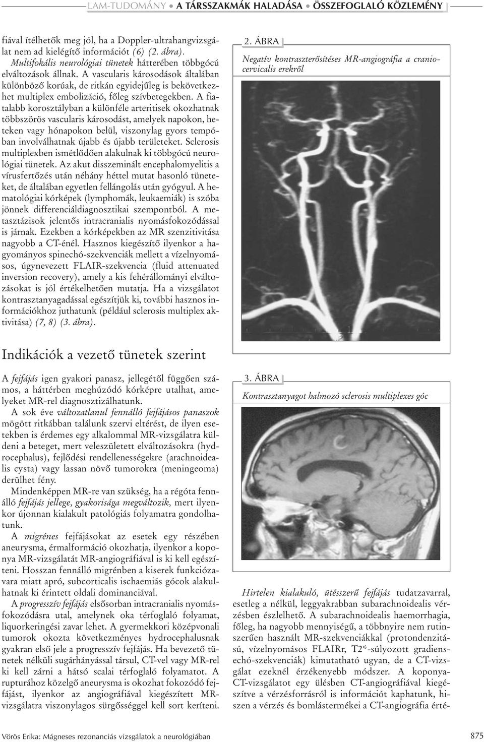 A fiatalabb korosztályban a különféle arteritisek okozhatnak többszörös vascularis károsodást, amelyek napokon, heteken vagy hónapokon belül, viszonylag gyors tempóban involválhatnak újabb és újabb