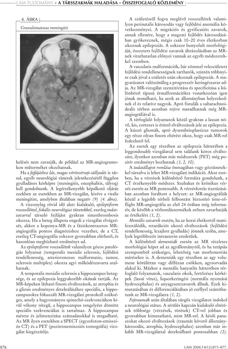 A legérzékenyebb képalkotó eljárás ezekben az esetekben az MR-vizsgálat, kivéve a viralis meningitist, amelyben általában negatív (9) (4. ábra).