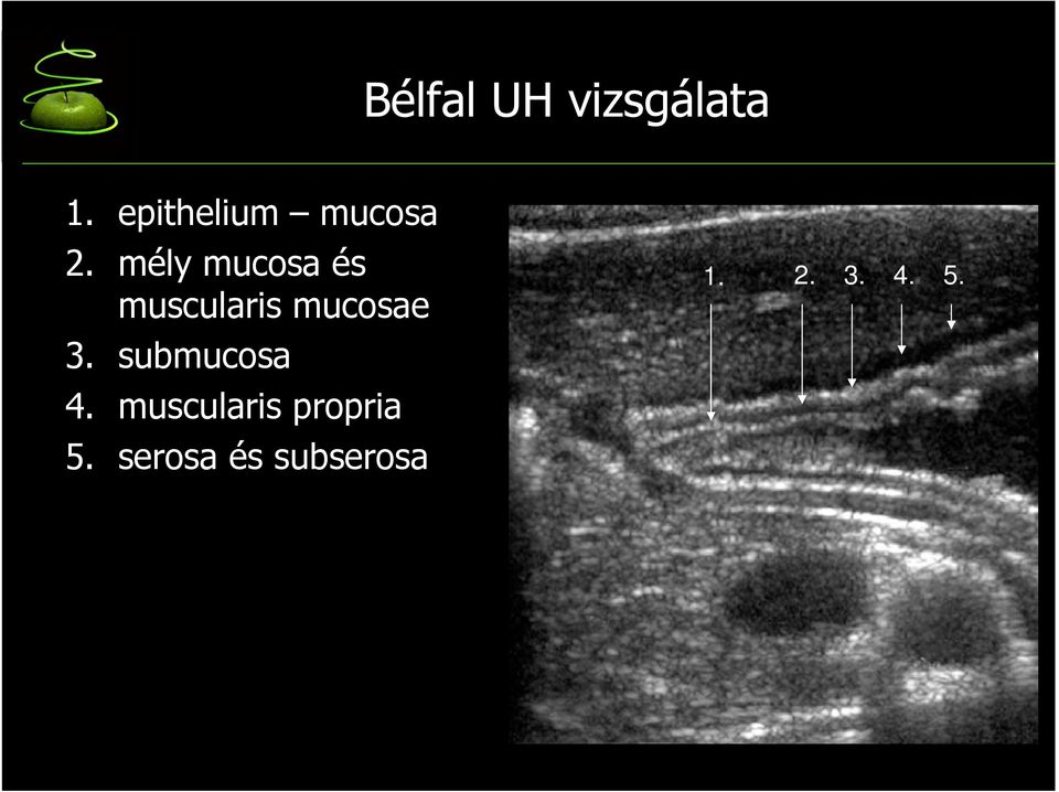 mély mucosa és muscularis mucosae 3.