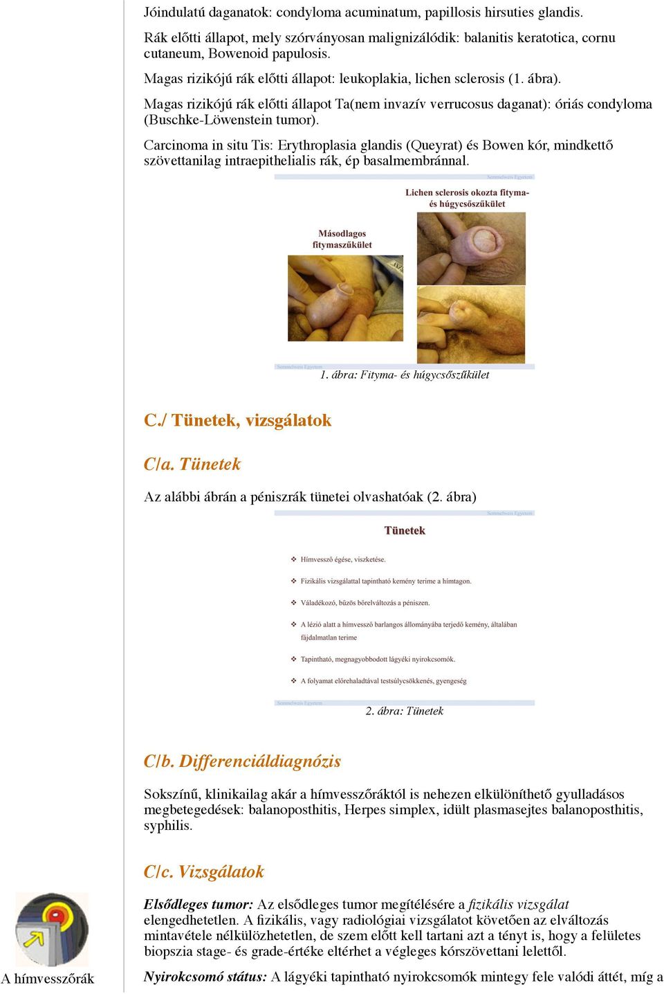 Carcinoma in situ Tis: Erythroplasia glandis (Queyrat) és Bowen kór, mindkettő szövettanilag intraepithelialis rák, ép basalmembránnal. 1. ábra: Fityma- és húgycsőszűkület C.