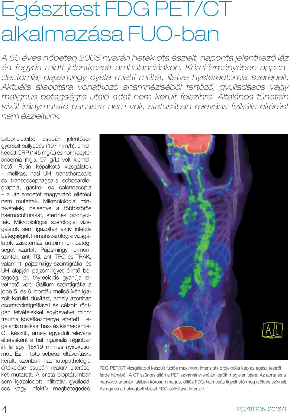 Aktuális állapotára vonatkozó anamnéziséből fertőző, gyulladásos vagy malignus betegségre utaló adat nem került felszínre.