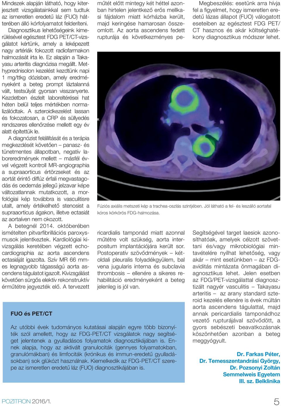 Ez alapján a Ta kayasu arteritis diagnózisa megállt. Methyprednisolon kezelést kezdtünk napi 1 mg/ttkg dózisban, amely eredményeként a beteg prompt láztalanná vált, testsúlyát gyorsan visszanyerte.