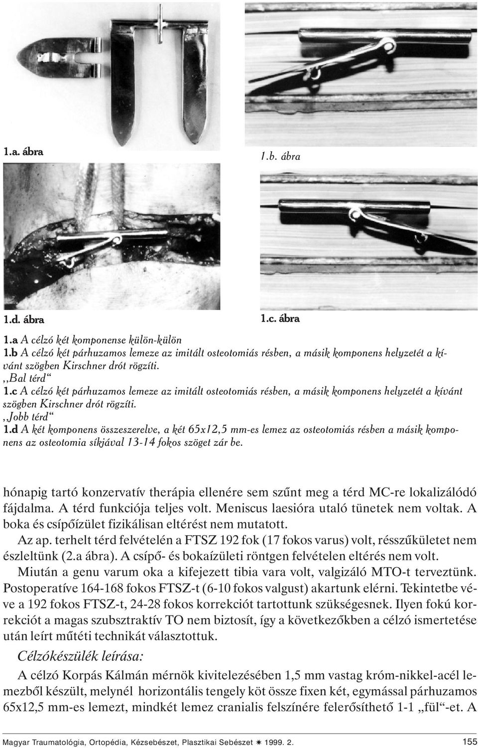 c A célzó két párhuzamos lemeze az imitált osteotomiás résben, a másik komponens helyzetét a kívánt szögben Kirschner drót rögzíti.,,jobb térd 1.