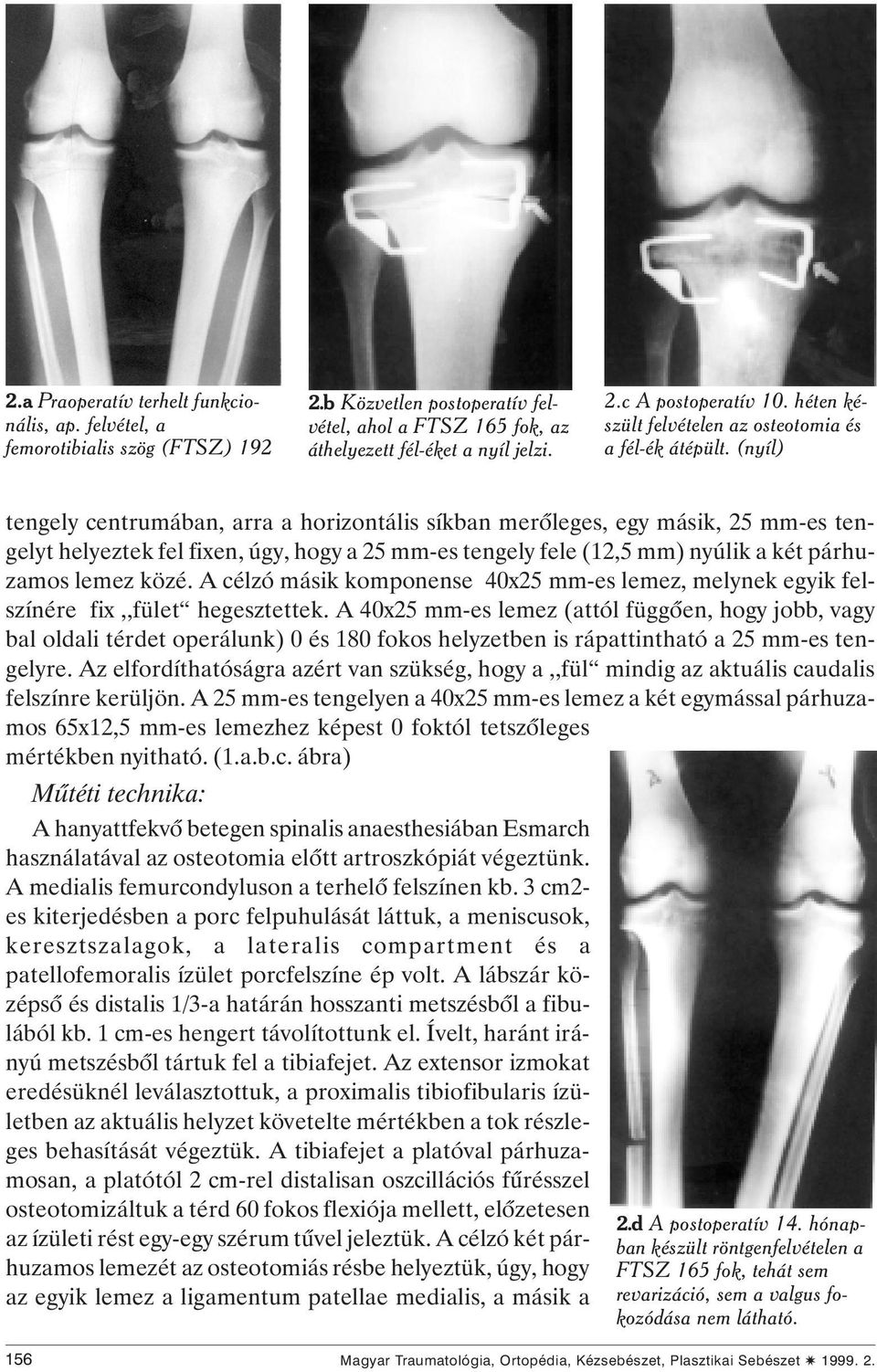 (nyíl) tengely centrumában, arra a horizontális síkban merôleges, egy másik, 25 mm-es tengelyt helyeztek fel fixen, úgy, hogy a 25 mm-es tengely fele (12,5 mm) nyúlik a két párhuzamos lemez közé.