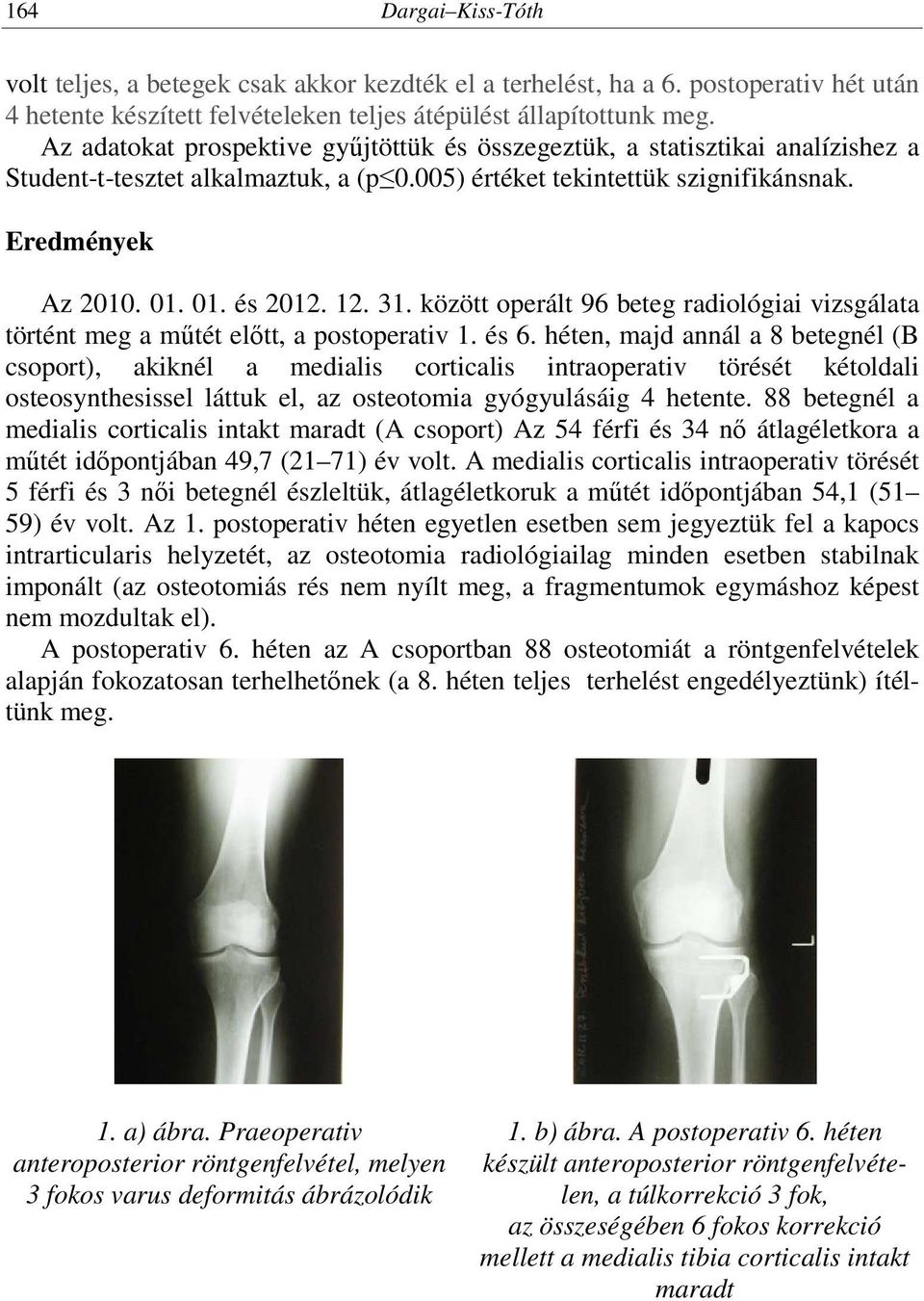 31. között operált 96 beteg radiológiai vizsgálata történt meg a műtét előtt, a postoperativ 1. és 6.