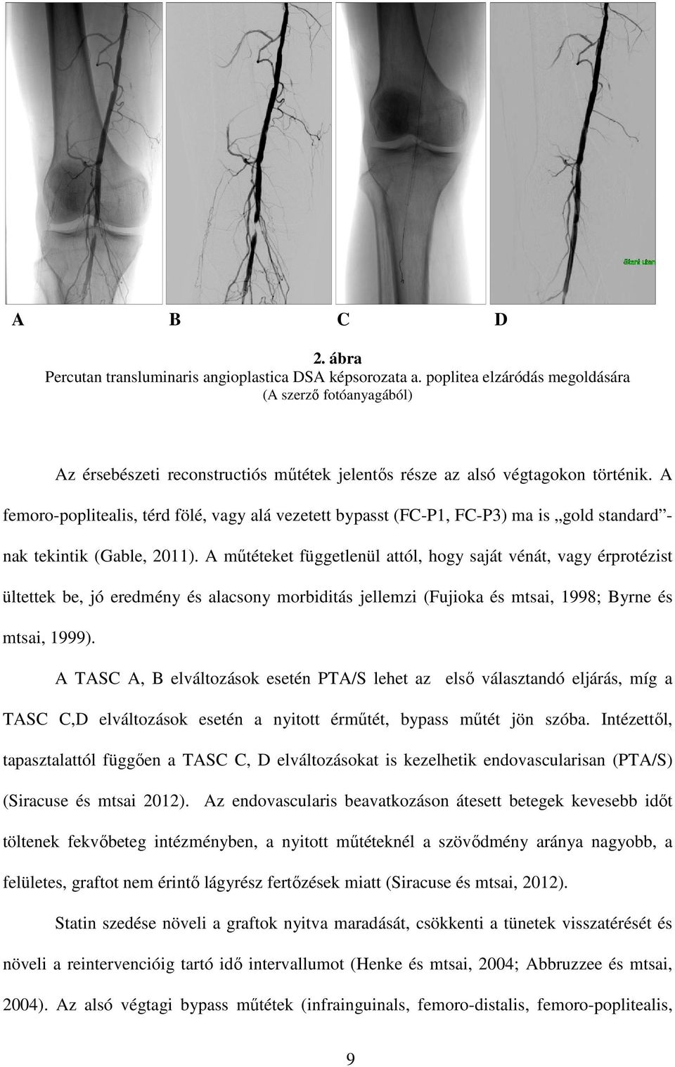 A femoro-poplitealis, térd fölé, vagy alá vezetett bypasst (FC-P1, FC-P3) ma is gold standard - nak tekintik (Gable, 2011).