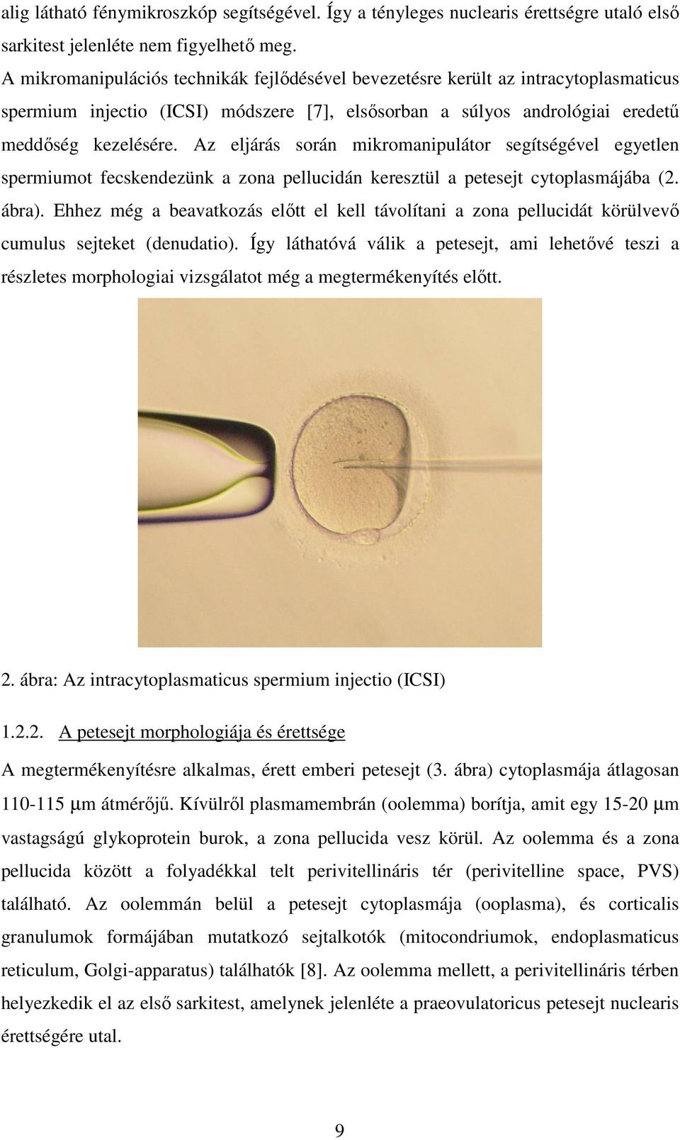 Az eljárás során mikromanipulátor segítségével egyetlen spermiumot fecskendezünk a zona pellucidán keresztül a petesejt cytoplasmájába (2. ábra).