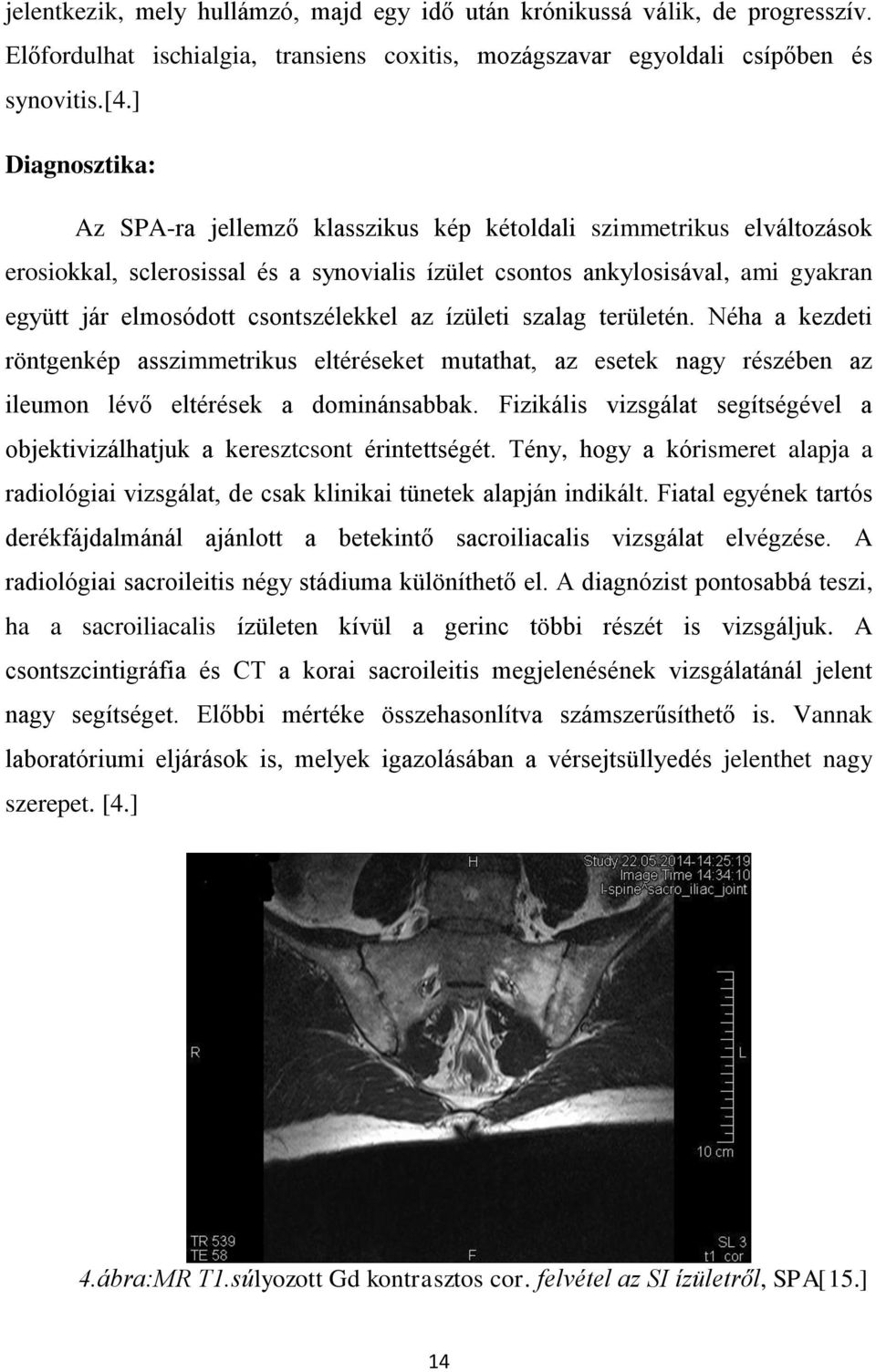 csontszélekkel az ízületi szalag területén. Néha a kezdeti röntgenkép asszimmetrikus eltéréseket mutathat, az esetek nagy részében az ileumon lévő eltérések a dominánsabbak.