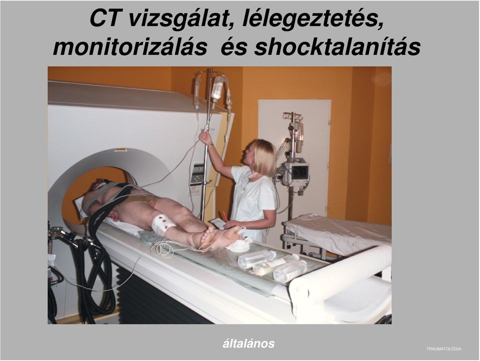 monitorizálás és