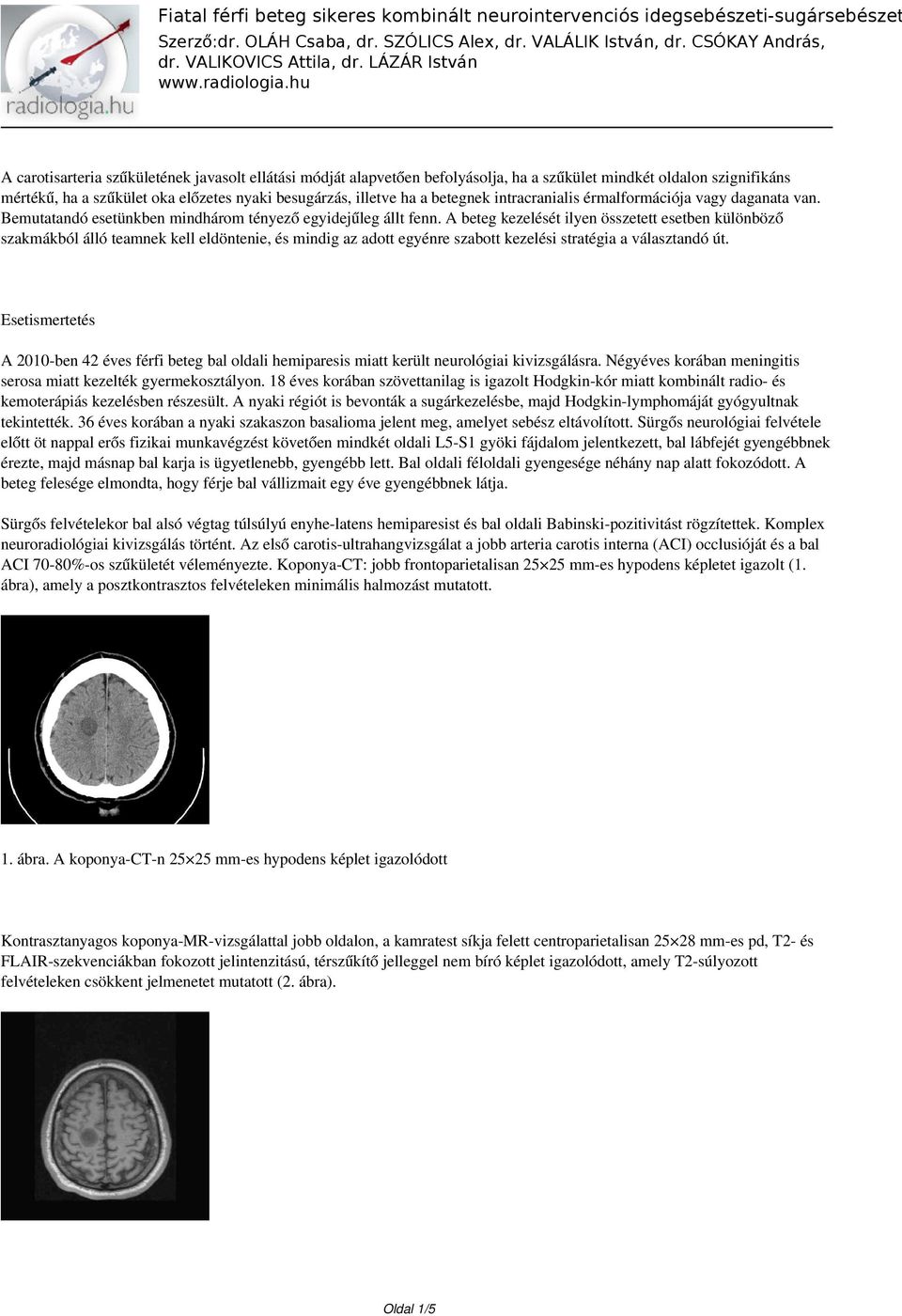 Fiatal férfi beteg sikeres kombinált neurointervenciós  idegsebészeti-sugársebészet - PDF Free Download