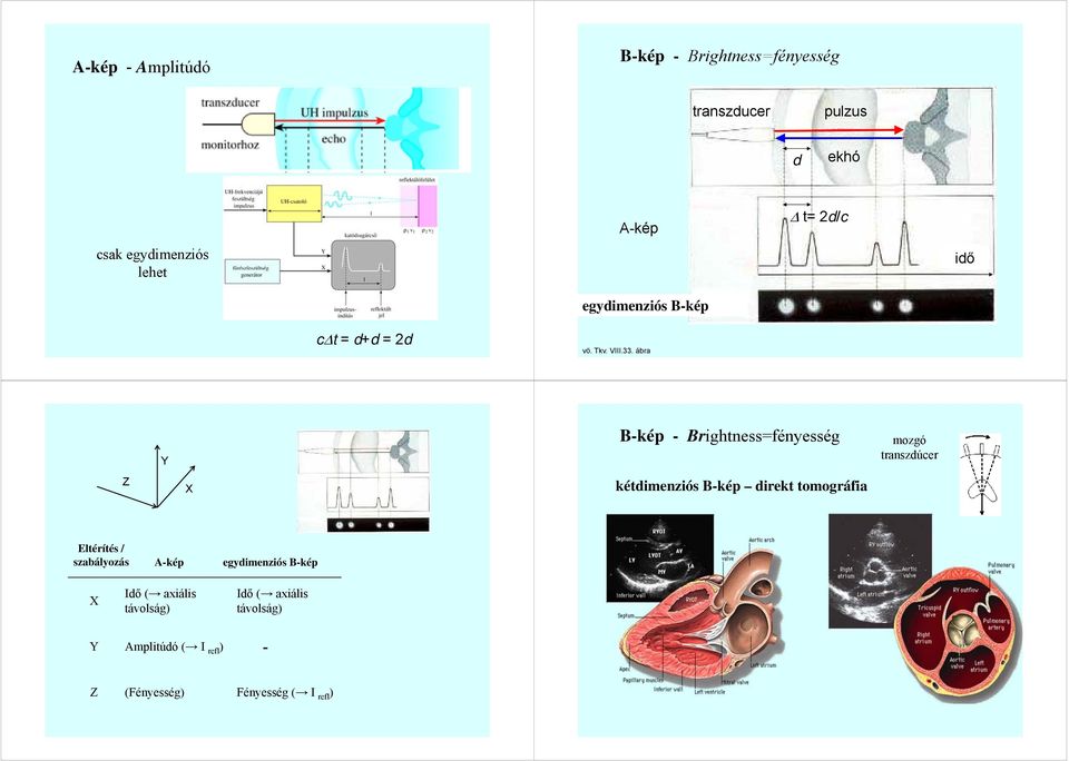 ábra Y B-kép - Brightness=fényesség mozgó transzdúcer Z kétdimenziós B-kép direkt tomográfia Eltérítés /