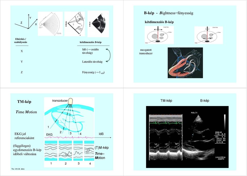 (Fényesség) Fényesség ( I refl ) Fényesség ( I refl ) TM-kép TM-kép B-kép Time Motion EKG jel