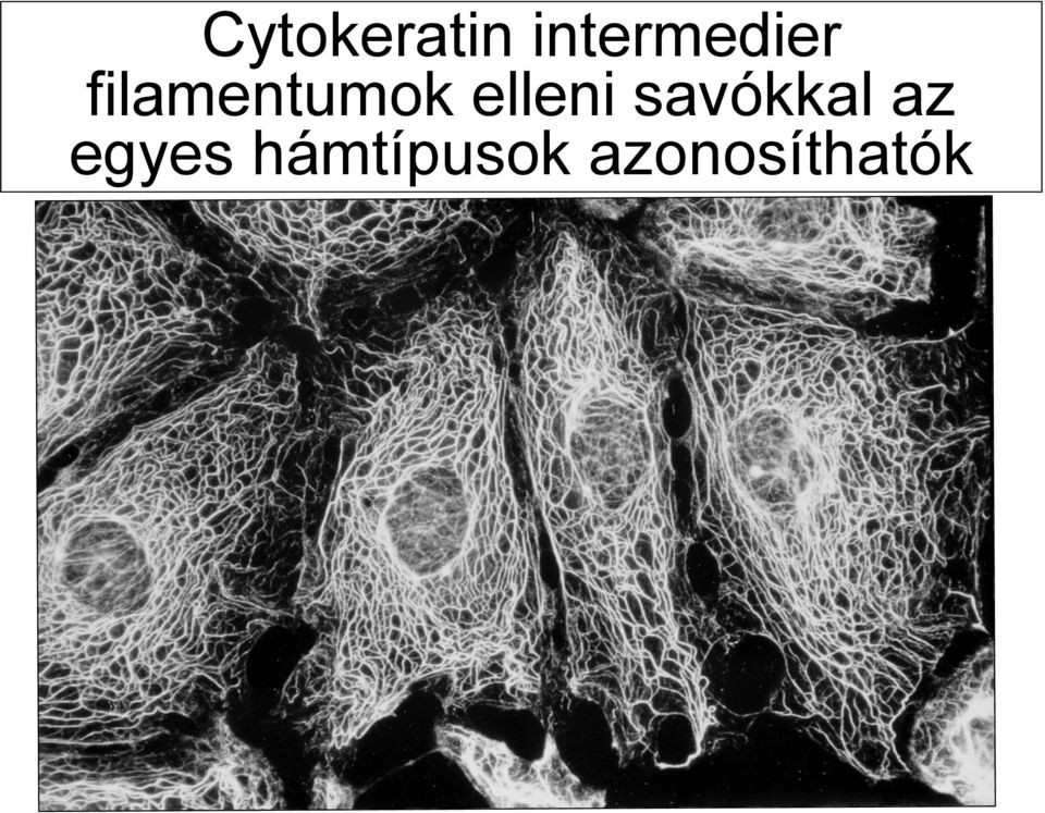 filamentumok elleni