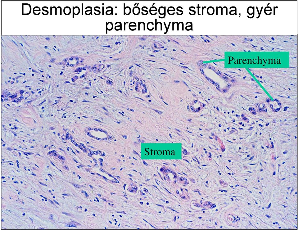 gyér parenchyma