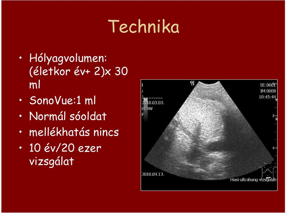 SonoVue:1 ml Normál sóoldat