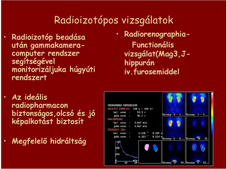 Radiorenographia- Functionális vizsgálat(mag3,jhippurán iv.