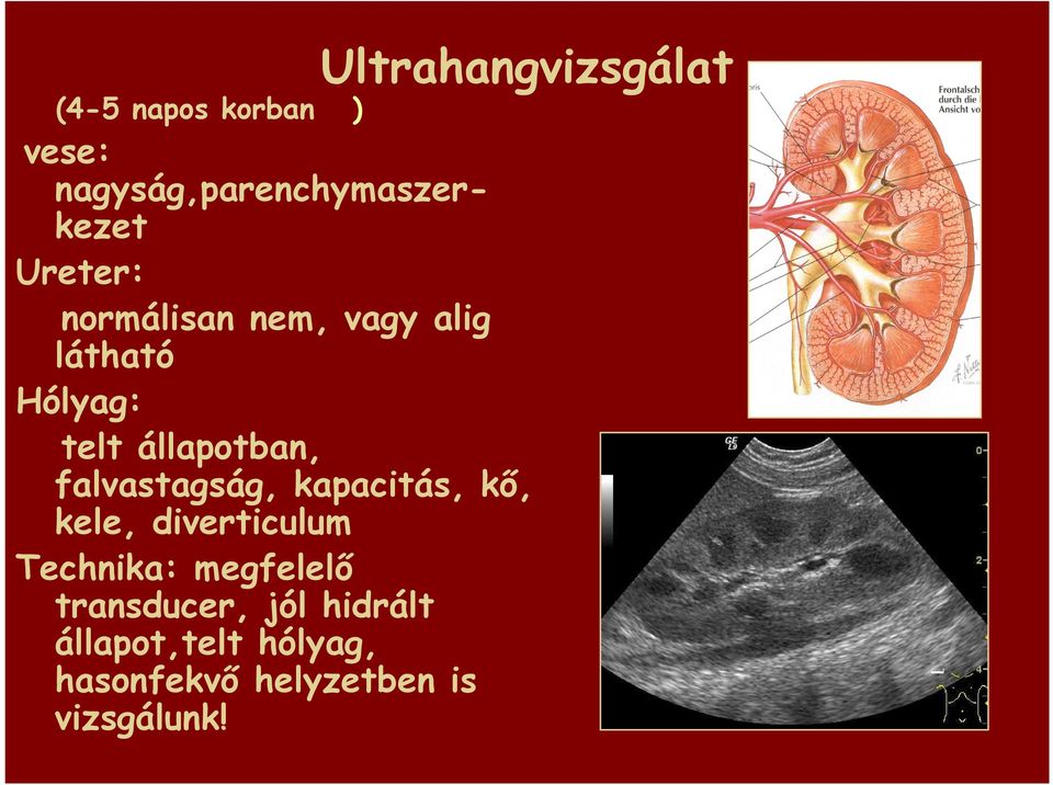 falvastagság, kapacitás, kı, kele, diverticulum Technika: megfelelı