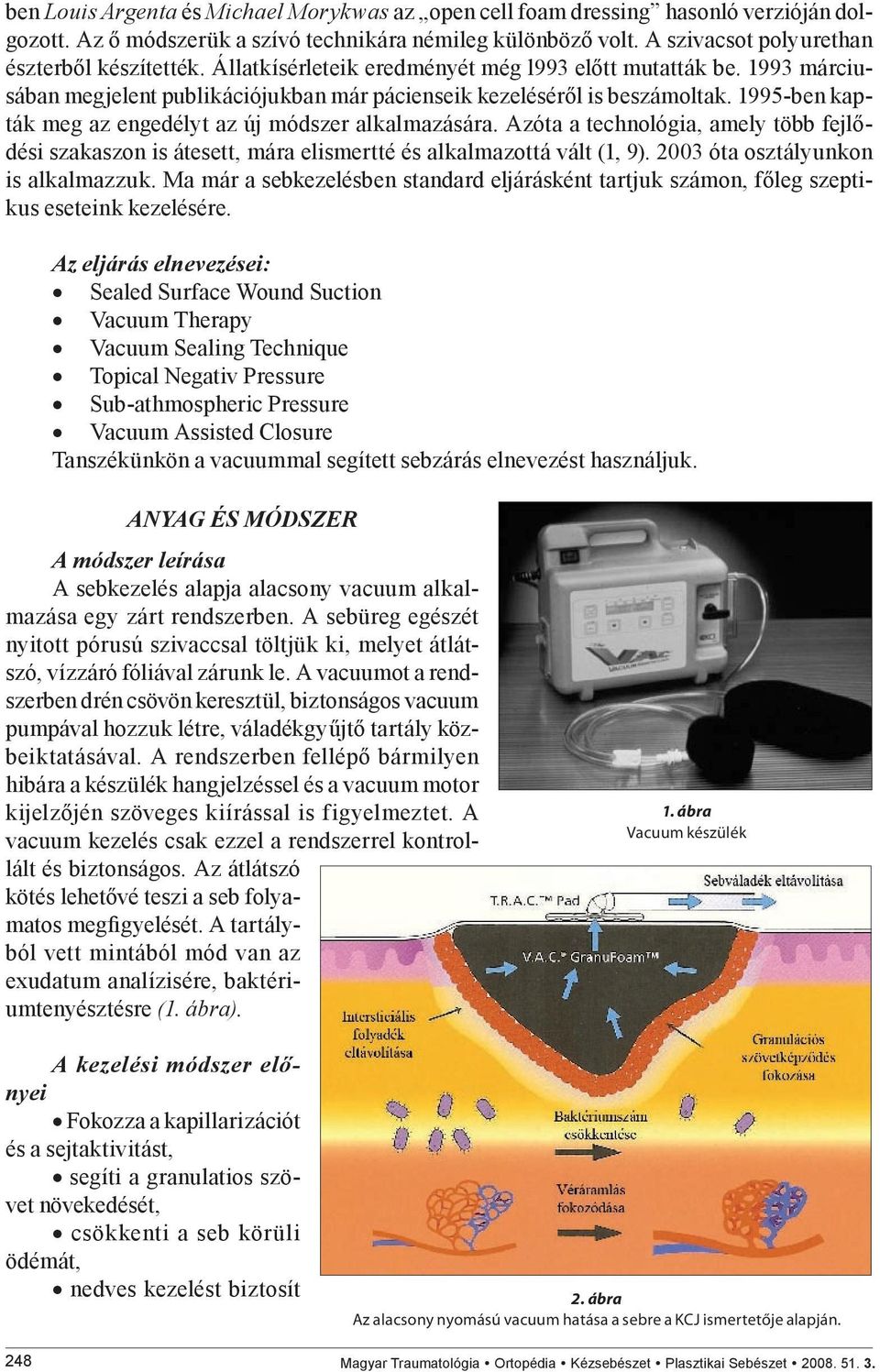 1995-ben kapták meg az engedélyt az új módszer alkalmazására. Azóta a technológia, amely több fejlődési szakaszon is átesett, mára elismertté és alkalmazottá vált (1, 9).