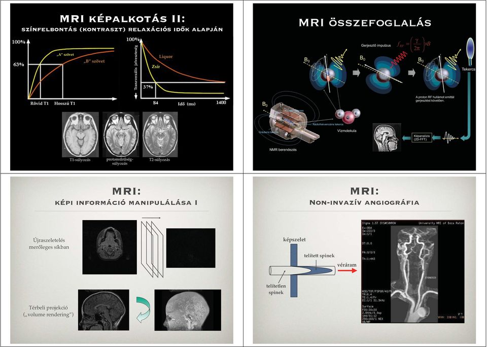 Kriogén mágnes Grádiens tekercs Rádiofrekvenciáns tekercs Vízmolekula Képanalízis (2D-FFT) NMR berendezés T1-súlyozás protonsűrűségsúlyozás