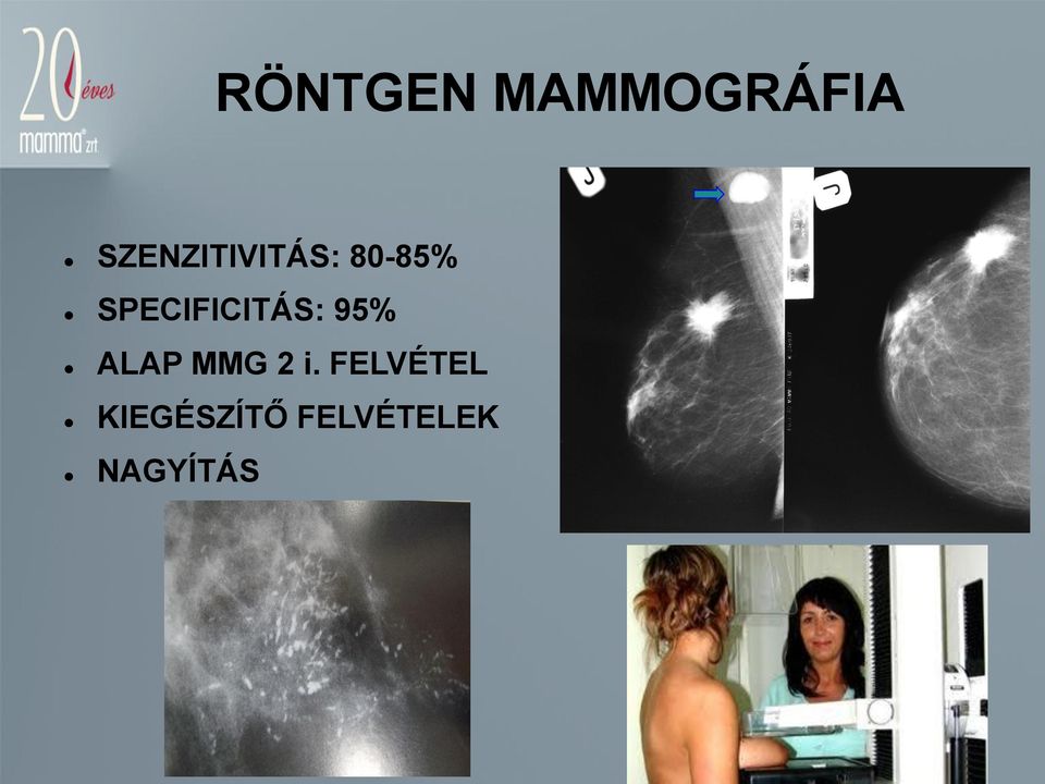 SPECIFICITÁS: 95% ALAP MMG 2