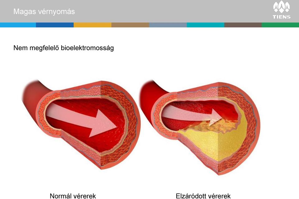 bioelektromosság