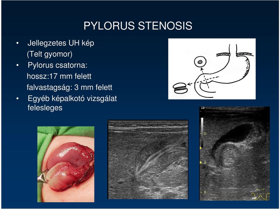 falvastagság: 3 mm felett Egyéb