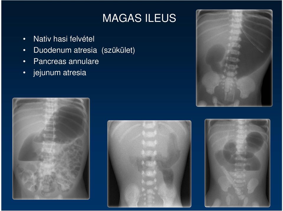 (szőkület) Pancreas