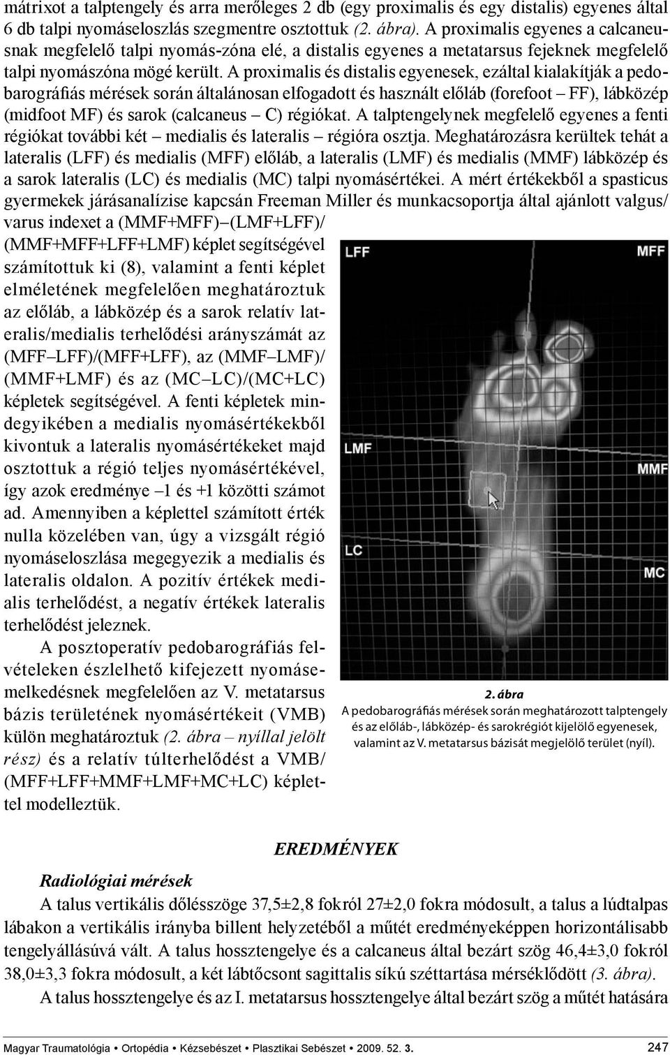 A proximalis és distalis egyenesek, ezáltal kialakítják a pedobarográfiás mérések során általánosan elfogadott és használt előláb (forefoot FF), lábközép (midfoot MF) és sarok (calcaneus C) régiókat.