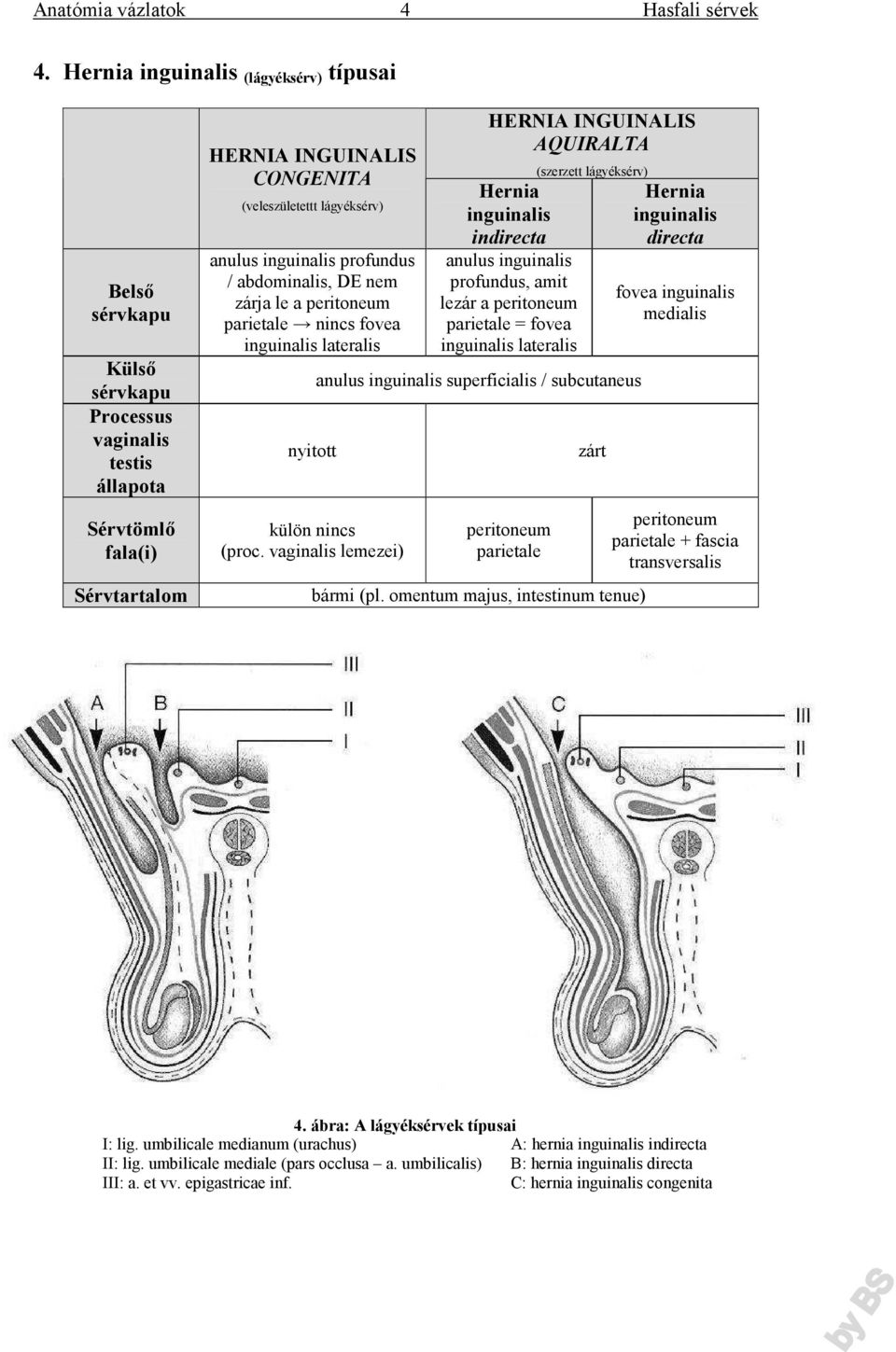 vaginalis lemezei) HERNIA INGUINALIS AQUIRALTA Hernia inguinalis indirecta anulus inguinalis profundus, amit lezár a peritoneum parietale = fovea inguinalis lateralis (szerzett lágyéksérv) anulus