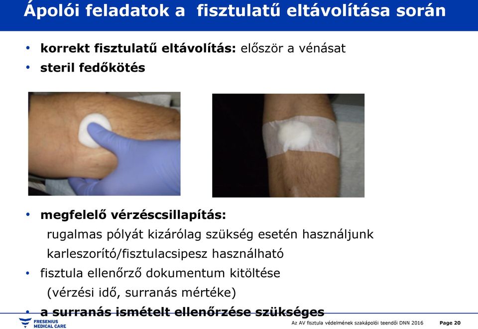 esetén használjunk karleszorító/fisztulacsipesz használható fisztula ellenőrző dokumentum
