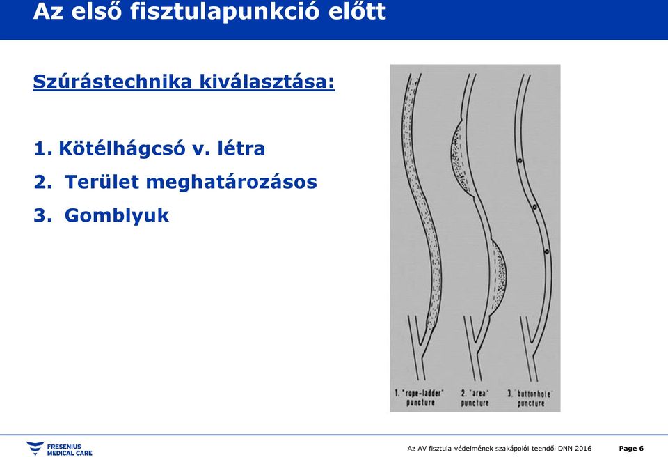 Kötélhágcsó v. létra 2.