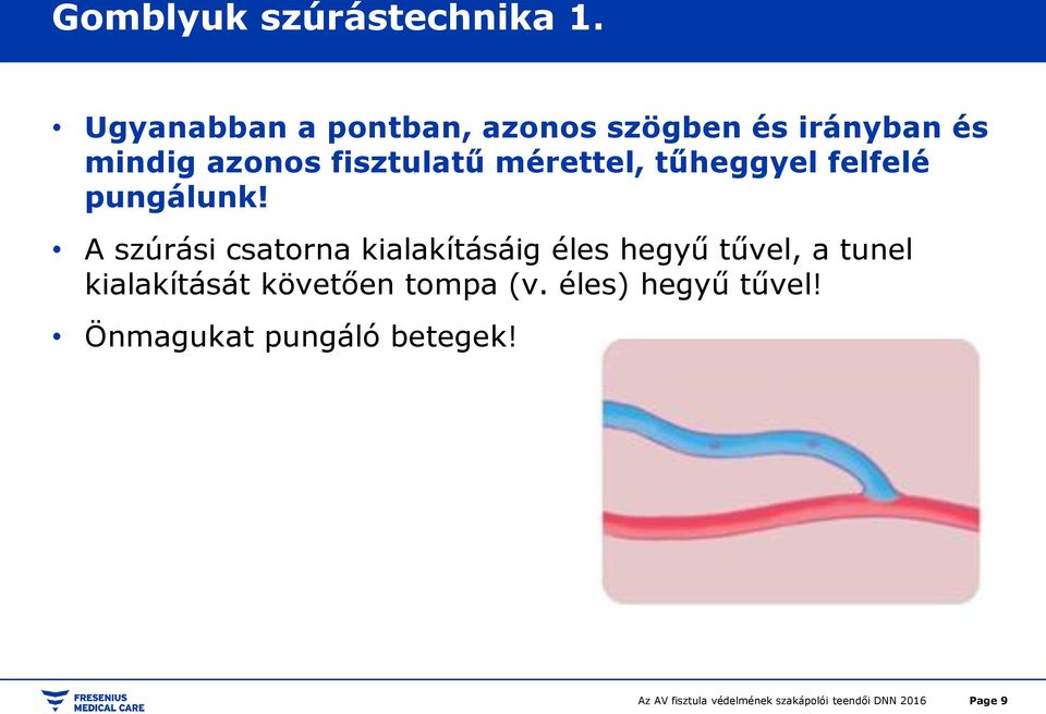 fisztulatű mérettel, tűheggyel felfelé pungálunk!