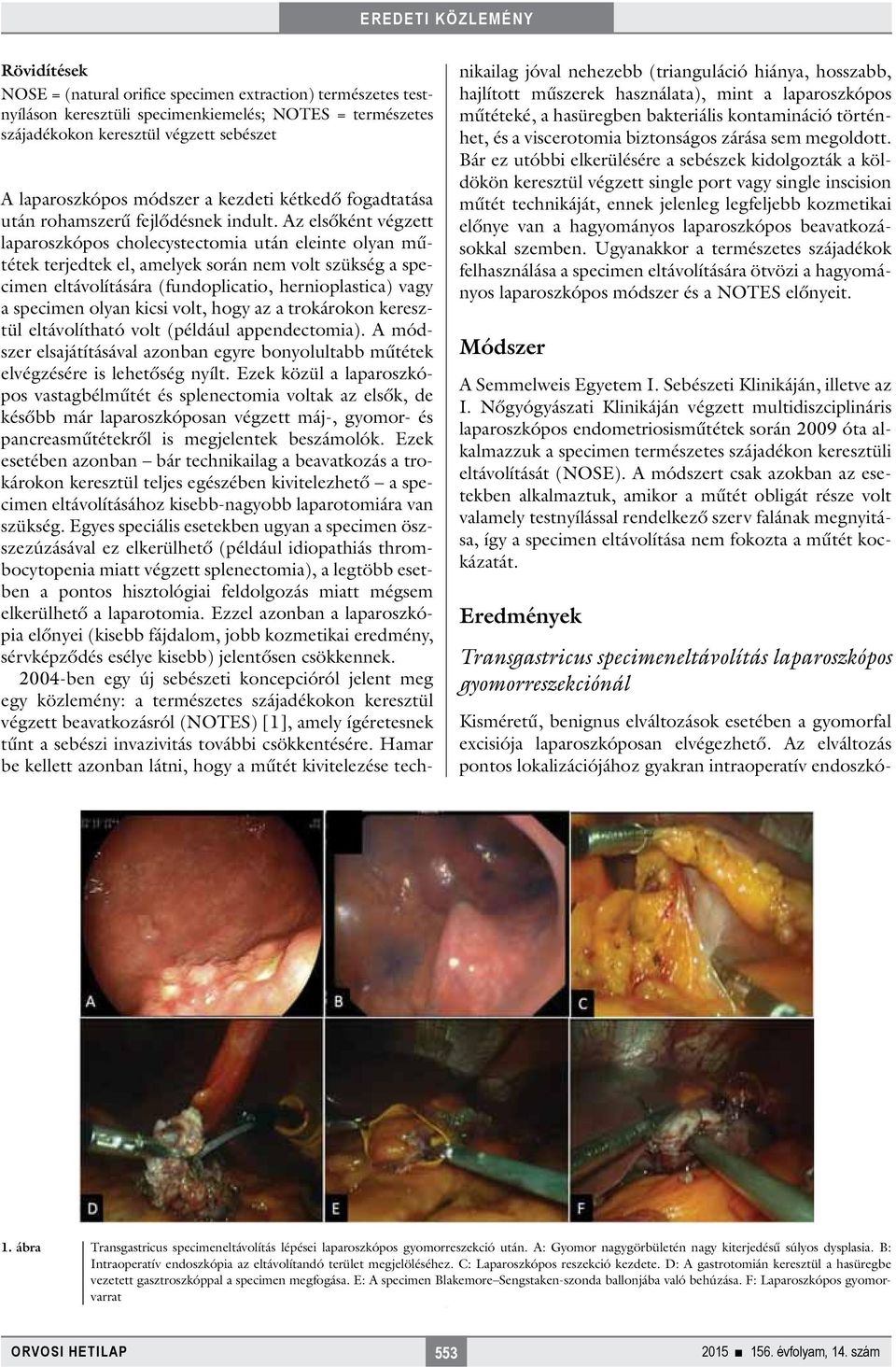 Az elsőként végzett laparoszkópos cholecystectomia után eleinte olyan műtétek terjedtek el, amelyek során nem volt szükség a specimen eltávolítására (fundoplicatio, hernioplastica) vagy a specimen