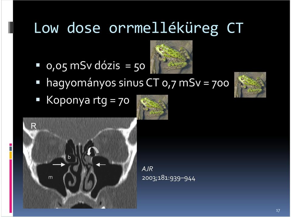hagyományos sinus CT 0,7 msv=