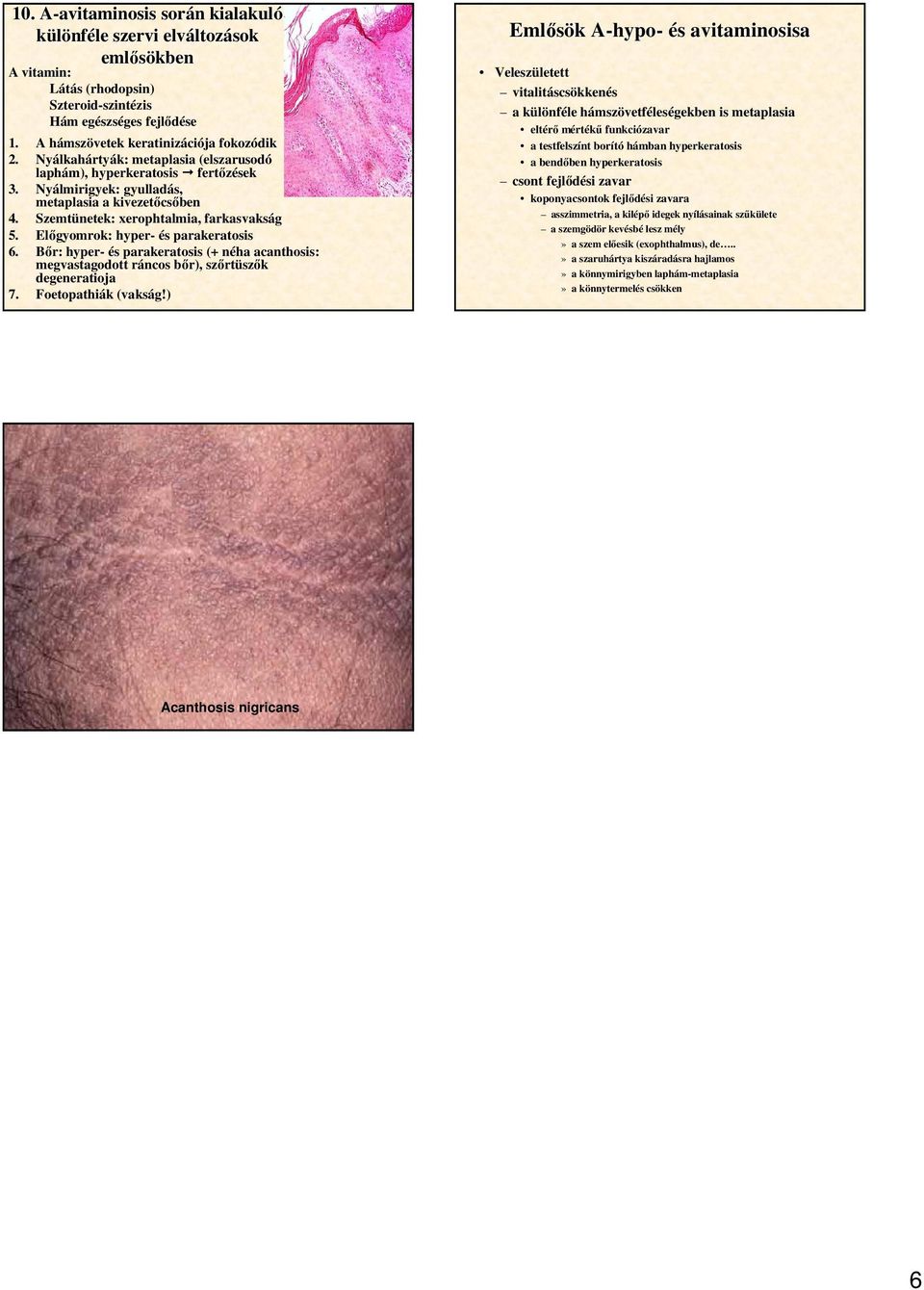 Szemtünetek: xerophtalmia, farkasvakság 5. Elıgyomrok: hyper- és parakeratosis 6. Bır: hyper- és parakeratosis (+ néha acanthosis: megvastagodott ráncos bır), szırtüszık degeneratioja 7.