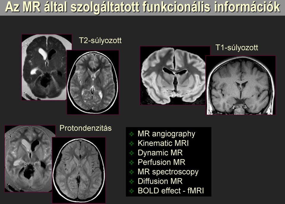 Protondenzitás MR angiography Kinematic MRI