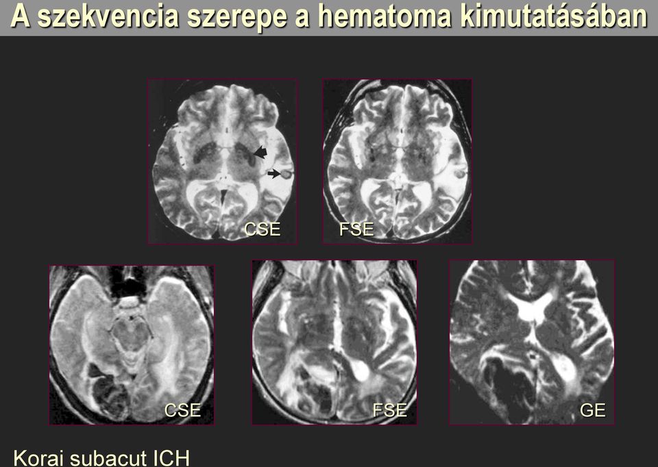 kimutatásában CSE