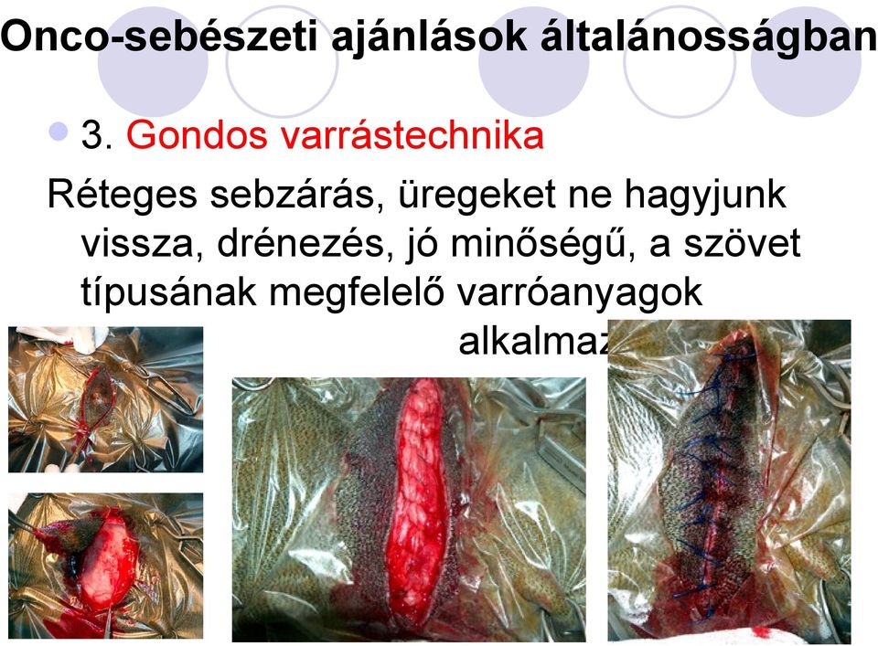 üregeket ne hagyjunk vissza, drénezés, jó