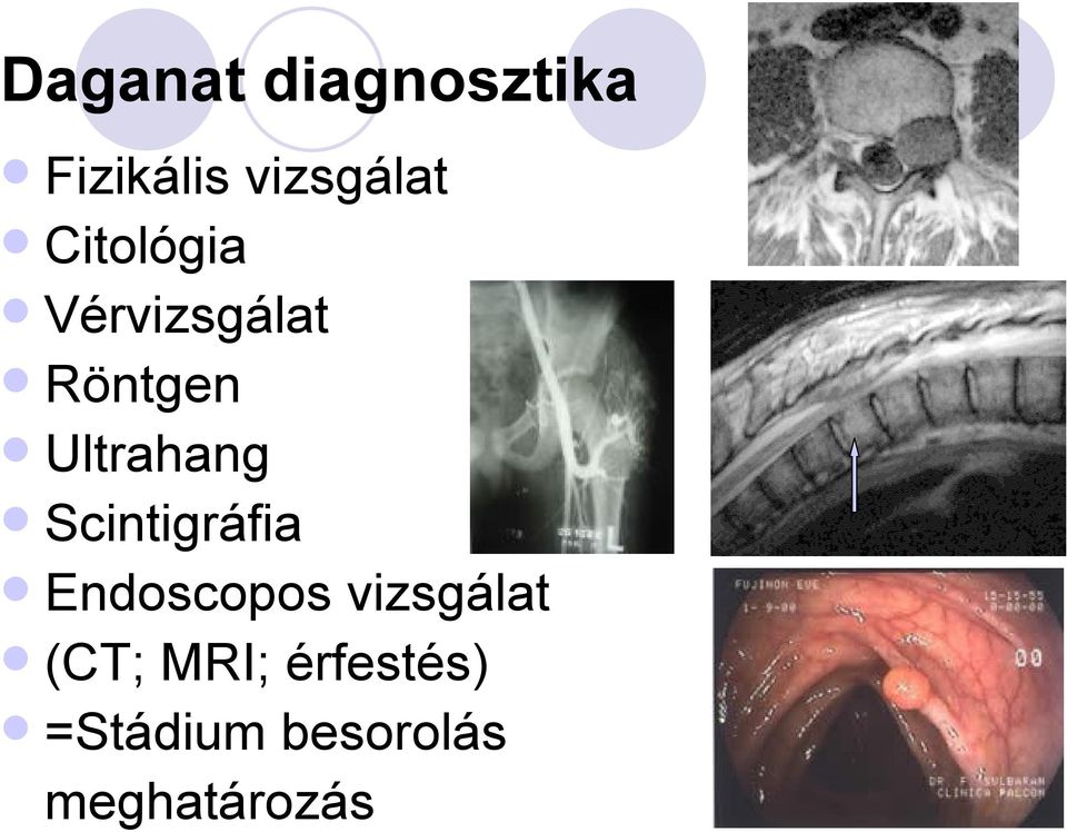 Scintigráfia Endoscopos vizsgálat (CT;