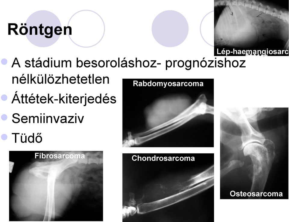 nélkülözhetetlen Rabdomyosarcoma