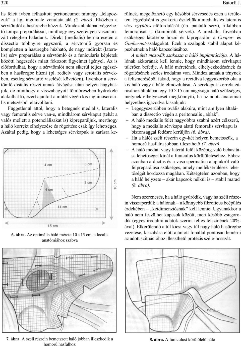 A lágyéktáji és hasfali sérvek laparoscopos műtétei áttekintés - PDF  Ingyenes letöltés