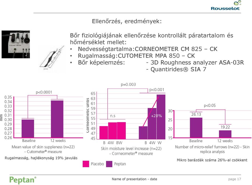 Rugalmasság:CUTOMETER MPA 850 CK Bőr képelemzés: - 3D Roughness analyzer ASA-03R