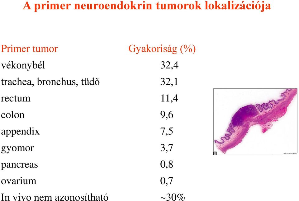 tüdő 32,1 rectum 11,4 colon 9,6 appendix 7,5 gyomor