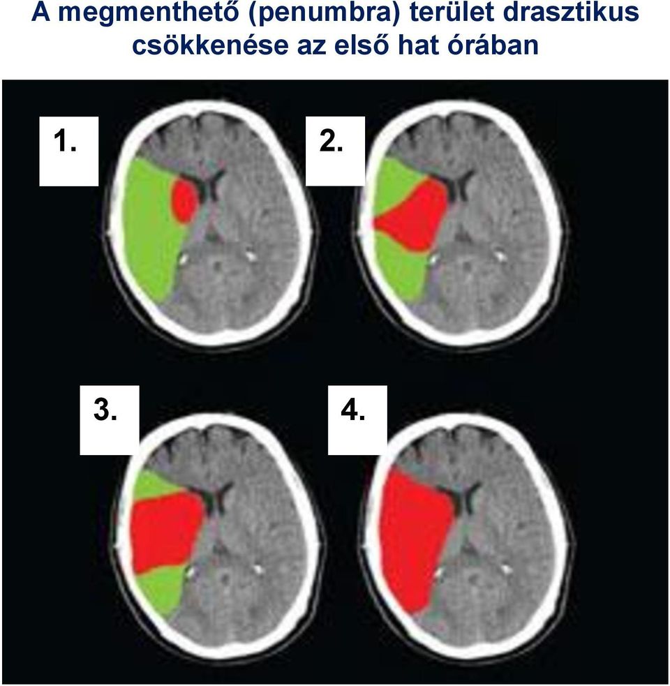 drasztikus csökkenése