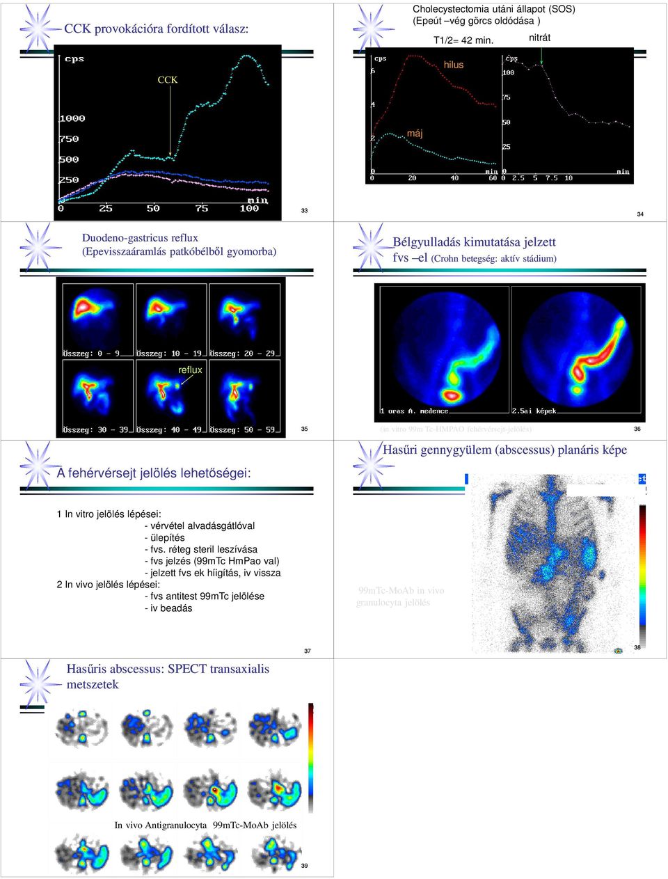 lehetőségei: 35 (in vitro 99m Tc-HMPAO fehérvérsejt-jelölés) 36 Hasűri gennygyülem (abscessus) planáris képe 1 In vitro jelölés lépései: - vérvétel alvadásgátlóval - ülepítés - fvs.