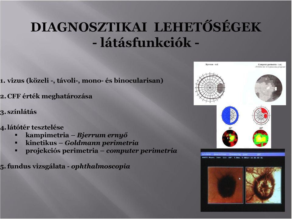 CFF érték meghatározása. színlátás.