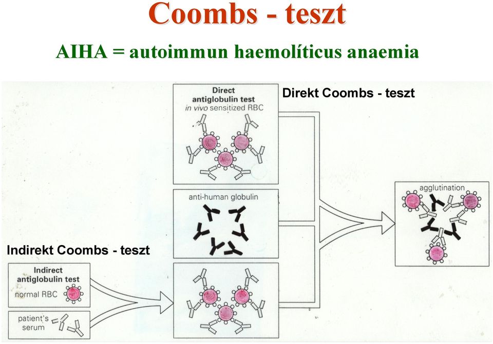 anaemia Direkt Coombs -