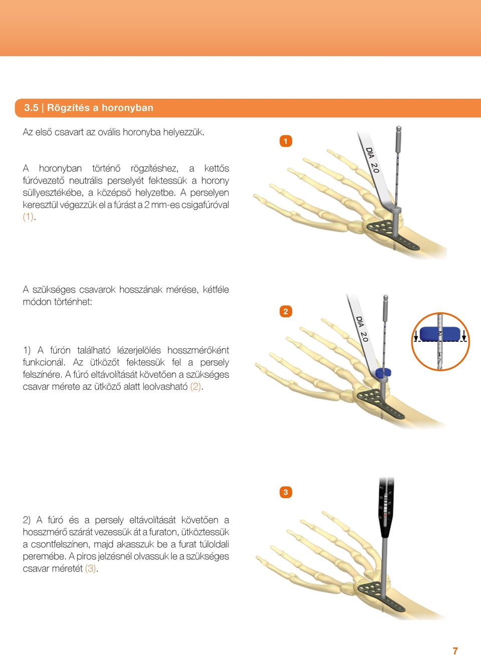 A perselyen keresztül végezzük el a fúrást a 2 mm-es csigafúróval (1).