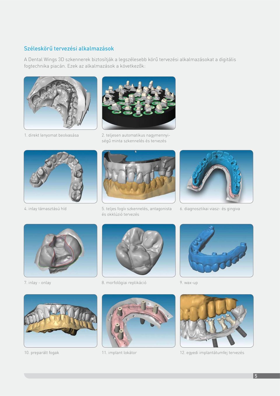 teljesen automatikus nagymennyiségű minta szkennelés és tervezés 4. inlay támasztású híd 5.