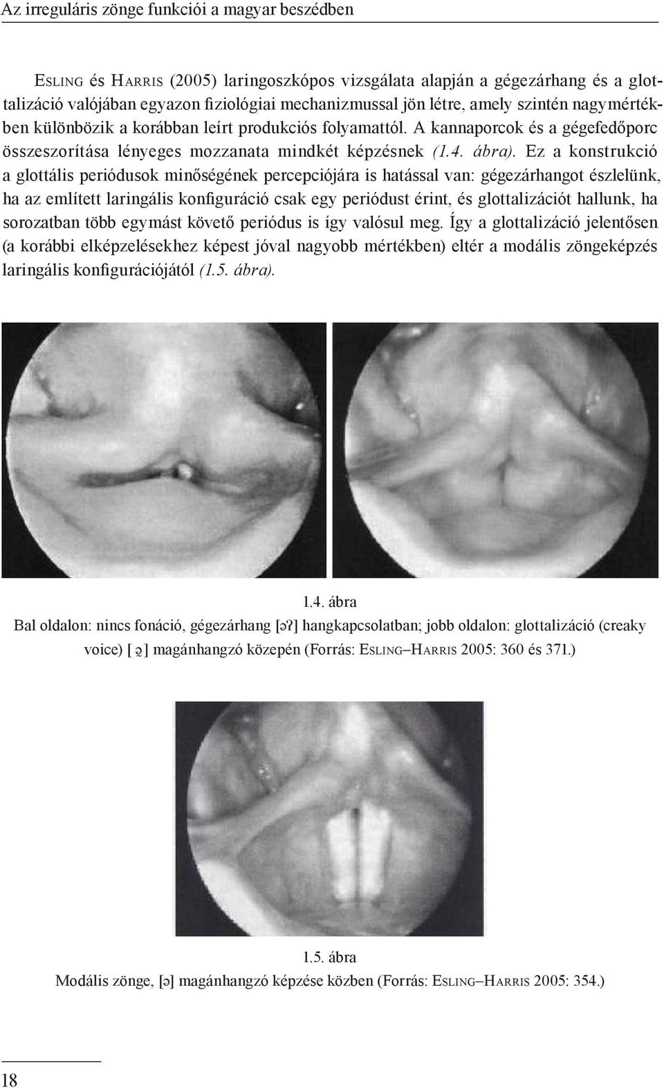 Ez a konstrukció a glottális periódusok minőségének percepciójára is hatással van: gégezárhangot észlelünk, ha az említett laringális konfiguráció csak egy periódust érint, és glottalizációt hallunk,